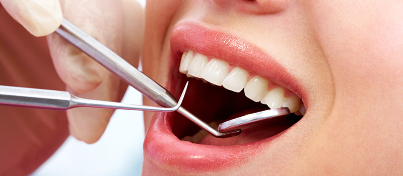 歯周病から歯を守る～歯周病・予防処置～